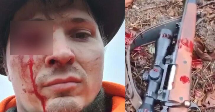 Graphic Warning: Hunter Is Charged By Deer And Receives Antlers To The Face